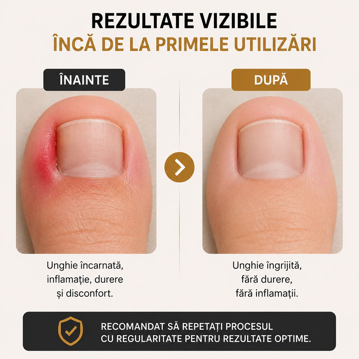 Unghieră profesională pentru unghii încarnate