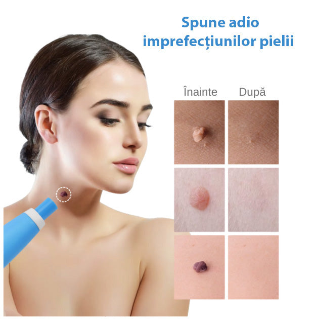 Kit Eliminator de Papiloame şi Imperfecțiuni ale pielii